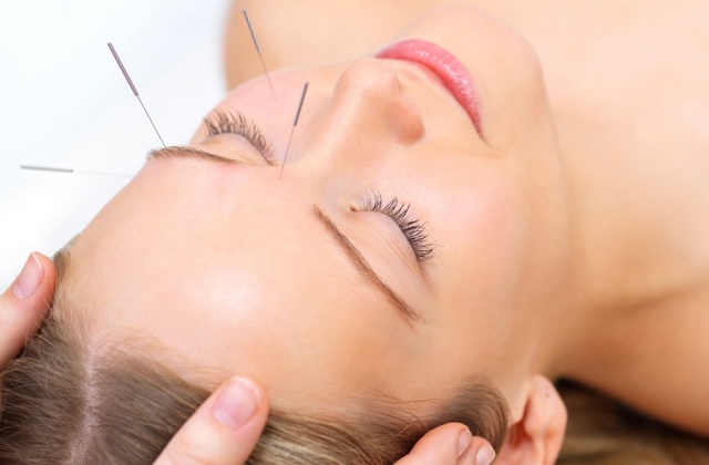 Cosmetic acupuncture